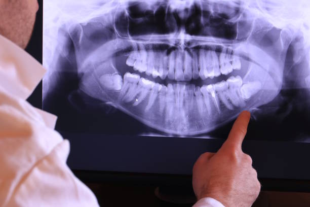 Best Broken or Cracked Tooth Emergency Dentist in Stockton University, NJ